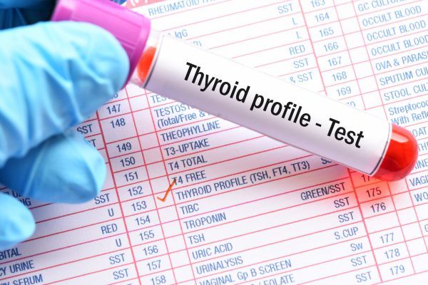 Thyroid Profile Basic