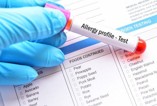 IgG Delayed Reaction (96 Foods) blood draw